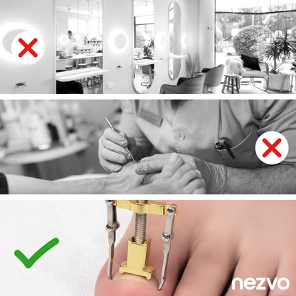 Correcteur D’Ongles Incarnés – Soulagement Et Soin Efficace