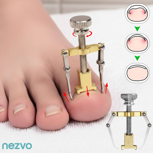 Correcteur D’Ongles Incarnés – Soulagement Et Soin Efficace