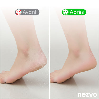 Râpe Électrique pour Pieds – Élimination Facile des Callosités & Peau Morte