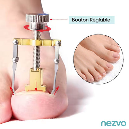 Correcteur D’Ongles Incarnés – Soulagement Et Soin Efficace