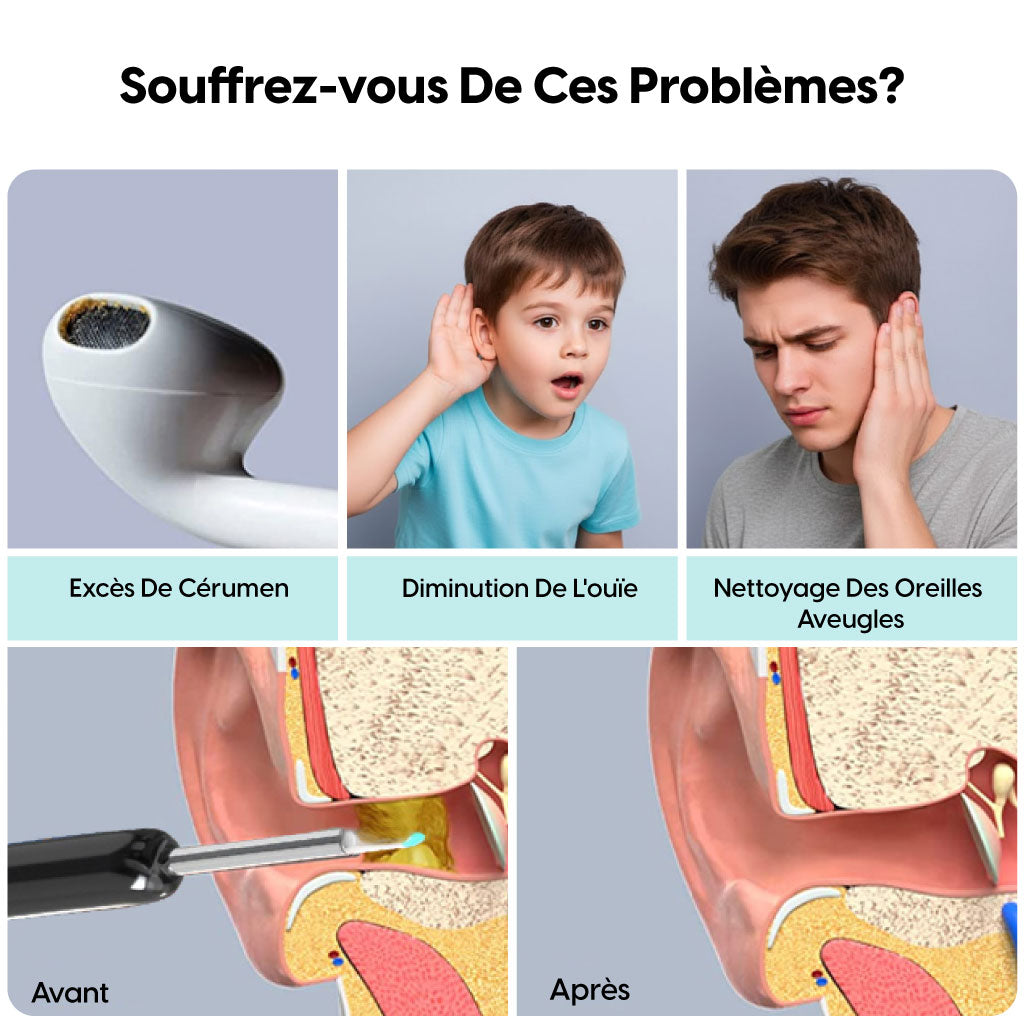 Caméra d’Oreille WiFi avec Nettoyeur Intelligent