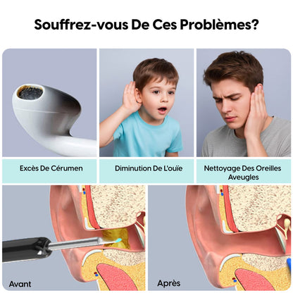Caméra d’Oreille WiFi avec Nettoyeur Intelligent