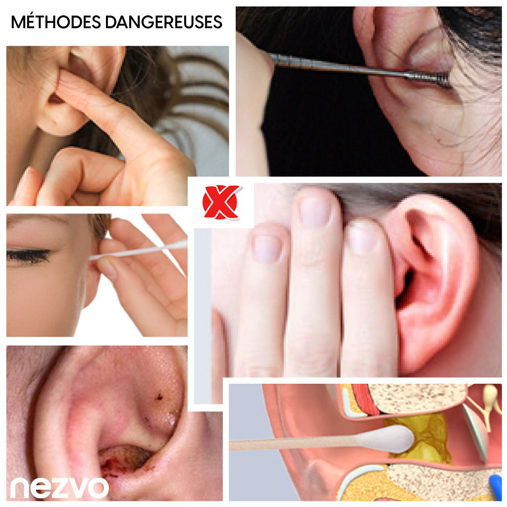 Caméra d’Oreille WiFi avec Nettoyeur Intelligent