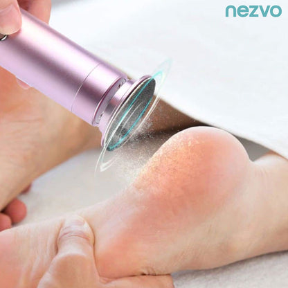 Râpe Électrique pour Pieds – Élimination Facile des Callosités & Peau Morte